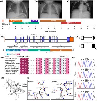 Case report: A novel JAK3 homozygous variant in a patient with severe combined immunodeficiency and persistent COVID-19